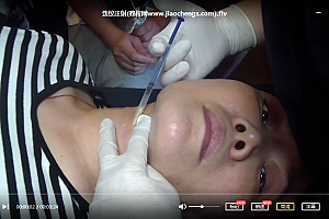 整形外科学手术视频教程鼻子面部颈部美国注射微整形方跃明教学光盘卫生部视听教材百度云网盘下载学习