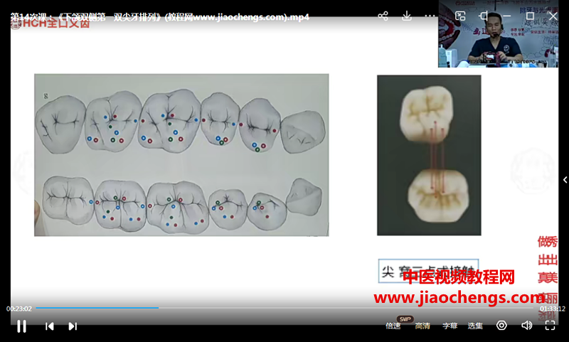 林崇运排牙跟训实操视频课程20集百度网盘下载学习