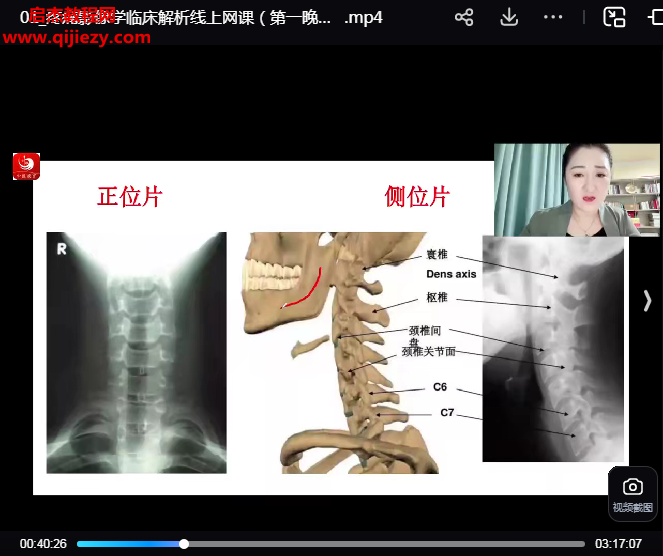 祁献灵疼痛影像学临床解析线上网课.png
