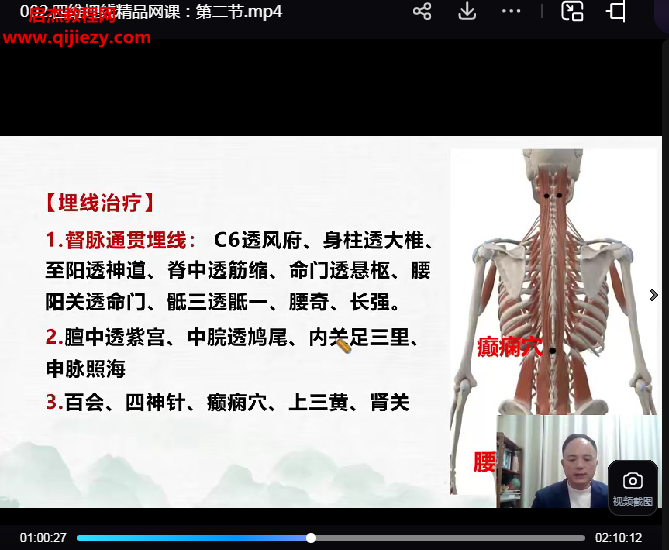 林君四维埋线.png