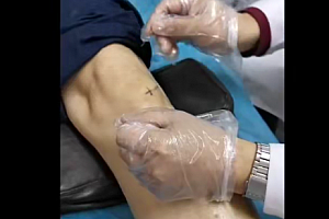 郭振存扳点肌筋膜五行脉法针灸临床实战课视频课程13集百度云网盘下载学习中医针灸教程