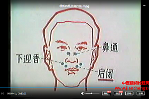 壮医药线点灸疗法文档视频资料百度云网盘下载学习