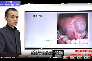 李祥平八纲九宫精确舌诊视频教程10集百度云网盘下载学习