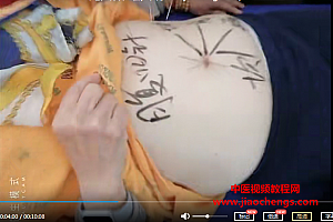 宗宥丞道家一气针精准13讲临床实战技术视频教程百度云网盘下载学习中医针灸教学视频