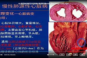 吉林大学病理学82讲李玉林等教授百度云网盘下载学习