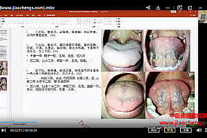 袁超明伤寒论方证立体舌诊视频课程23集完整版百度网盘下载学习