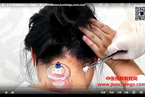 程冰雪岭南程派放血疗法专业课视频课程64集百度网盘下载学习