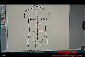 胡园穴位外治秘方贴药治疗减肥一针减肥绝技疗效立竿见影不易反弹视频课程1集百度网盘下载学习