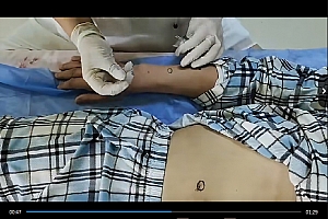 唐氏古医唐洪影教授太极阴阳针灸18种疾病一个穴位调一病症视频课程18集百度网盘下载学习