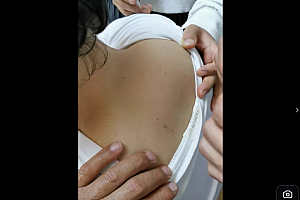 刘彦涛针灸函授班视频课程26集百度网盘下载学习